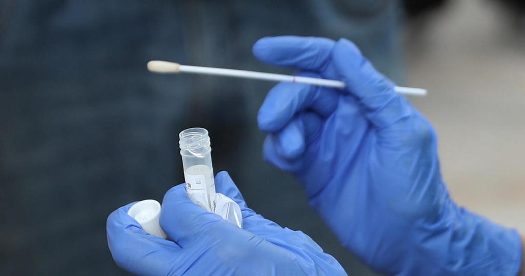 Swab Testing